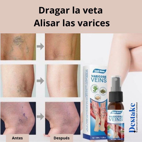 Varicose veins - Spray para Varices
